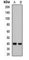 Homeobox protein Hox-A13 antibody, LS-C668627, Lifespan Biosciences, Western Blot image 