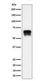 Cyclin Dependent Kinase 16 antibody, M06102, Boster Biological Technology, Western Blot image 