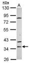 Zona Pellucida Glycoprotein 1 antibody, PA5-31686, Invitrogen Antibodies, Western Blot image 