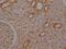 Selenoprotein P antibody, CSB-PA021018LA01HU, Cusabio, Immunohistochemistry paraffin image 