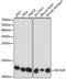 SEC61 Translocon Beta Subunit antibody, A15788, ABclonal Technology, Western Blot image 