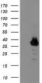 Zinc Finger Protein 397 antibody, NBP2-01324, Novus Biologicals, Western Blot image 