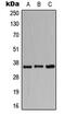 Bone Marrow Stromal Cell Antigen 1 antibody, MBS820379, MyBioSource, Western Blot image 