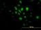 Serine/Threonine Kinase 33 antibody, LS-B4535, Lifespan Biosciences, Immunofluorescence image 