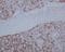 SATB Homeobox 2 antibody, M02588, Boster Biological Technology, Immunohistochemistry paraffin image 