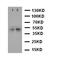 C-X-C Motif Chemokine Receptor 5 antibody, orb99183, Biorbyt, Western Blot image 