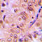 Akt antibody, LS-C358423, Lifespan Biosciences, Immunohistochemistry paraffin image 