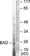 BCL2 Associated Agonist Of Cell Death antibody, TA312433, Origene, Western Blot image 