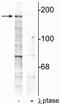 Glutamate Ionotropic Receptor NMDA Type Subunit 2B antibody, P01883-1, Boster Biological Technology, Western Blot image 