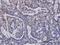 Ubiquitin Conjugating Enzyme E2 D1 antibody, H00007321-M01, Novus Biologicals, Immunohistochemistry paraffin image 