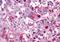 Vasoactive intestinal polypeptide receptor 1 antibody, MBS243550, MyBioSource, Immunohistochemistry frozen image 