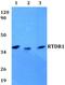 Radial Spoke Head 14 Homolog antibody, PA5-75747, Invitrogen Antibodies, Western Blot image 