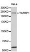 TAR (HIV-1) RNA Binding Protein 1 antibody, abx004676, Abbexa, Western Blot image 