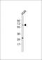 Dehydrogenase/Reductase 7C antibody, orb2423, Biorbyt, Western Blot image 