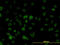 SWI/SNF Related, Matrix Associated, Actin Dependent Regulator Of Chromatin, Subfamily D, Member 2 antibody, LS-B5536, Lifespan Biosciences, Immunofluorescence image 