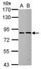 RBM35B antibody, PA5-32143, Invitrogen Antibodies, Western Blot image 