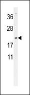 DMRT Like Family C1B antibody, LS-C167455, Lifespan Biosciences, Western Blot image 
