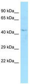 Exonuclease 5 antibody, TA333699, Origene, Western Blot image 