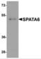 Spermatogenesis Associated 6 antibody, NBP2-81853, Novus Biologicals, Western Blot image 