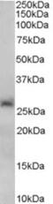 NAD-dependent deacetylase sirtuin-3, mitochondrial antibody, NB600-808, Novus Biologicals, Western Blot image 