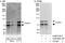 Forkhead Box P1 antibody, A302-620A, Bethyl Labs, Western Blot image 