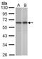 TNFAIP3 Interacting Protein 2 antibody, NBP1-32689, Novus Biologicals, Western Blot image 