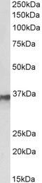Prdx6 antibody, 43-497, ProSci, Western Blot image 