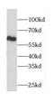 CaM Kinase Like Vesicle Associated antibody, FNab01239, FineTest, Western Blot image 