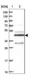 MINDY Lysine 48 Deubiquitinase 3 antibody, NBP1-88543, Novus Biologicals, Western Blot image 