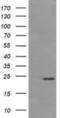 Deleted In Primary Ciliary Dyskinesia Homolog (Mouse) antibody, NBP2-45679, Novus Biologicals, Western Blot image 