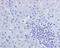 Androgen Receptor antibody, ab108341, Abcam, Immunohistochemistry paraffin image 