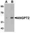 Angiopoietin 2 antibody, orb75734, Biorbyt, Western Blot image 