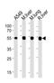 Aldehyde dehydrogenase, mitochondrial antibody, orb96226, Biorbyt, Western Blot image 