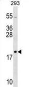 60S ribosomal protein L26 antibody, abx028796, Abbexa, Western Blot image 
