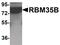 RBM35B antibody, PA5-21110, Invitrogen Antibodies, Western Blot image 