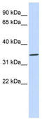 Rh Blood Group CcEe Antigens antibody, TA344172, Origene, Western Blot image 