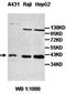 Zinc Finger CCCH-Type Containing 8 antibody, orb77679, Biorbyt, Western Blot image 
