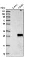 Potassium Voltage-Gated Channel Subfamily E Regulatory Subunit 4 antibody, PA5-52834, Invitrogen Antibodies, Western Blot image 