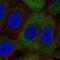 Nucleoporin 210 Like antibody, NBP2-55600, Novus Biologicals, Immunofluorescence image 