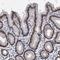 Zinc Finger Protein 529 antibody, HPA031311, Atlas Antibodies, Immunohistochemistry paraffin image 
