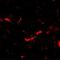 DLG Associated Protein 2 antibody, NBP2-82086, Novus Biologicals, Immunocytochemistry image 