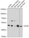 Myosin Regulatory Light Chain Interacting Protein antibody, GTX33337, GeneTex, Western Blot image 