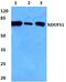 NADH:Ubiquinone Oxidoreductase Core Subunit S1 antibody, PA5-75538, Invitrogen Antibodies, Western Blot image 