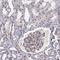 Ribonuclease P/MRP Subunit P38 antibody, HPA050398, Atlas Antibodies, Immunohistochemistry paraffin image 