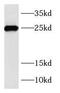 Ras-related protein Rab-39B antibody, FNab07023, FineTest, Western Blot image 