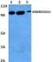 Ankyrin Repeat Domain 20 Family Member A1 antibody, PA5-75795, Invitrogen Antibodies, Western Blot image 