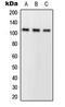 Phospholipase A2 Group IVA antibody, LS-C354047, Lifespan Biosciences, Western Blot image 
