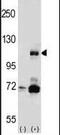 Phosphatidylinositol-4,5-bisphosphate 3-kinase catalytic subunit beta isoform antibody, PA5-15249, Invitrogen Antibodies, Western Blot image 