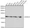 SWI/SNF Related, Matrix Associated, Actin Dependent Regulator Of Chromatin, Subfamily A, Member 5 antibody, 18-437, ProSci, Western Blot image 