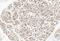 TNF Alpha Induced Protein 1 antibody, PA1305, Boster Biological Technology, Immunohistochemistry paraffin image 